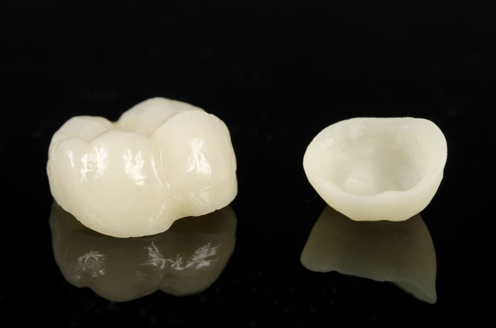 Ceramic Crowns