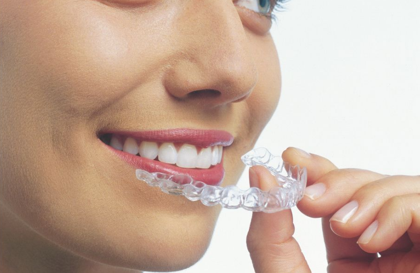 What You Should Know Before Getting Invisalign for Teens