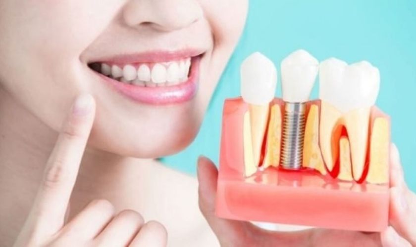 Dental Implants- Hygiene Tips, Risks