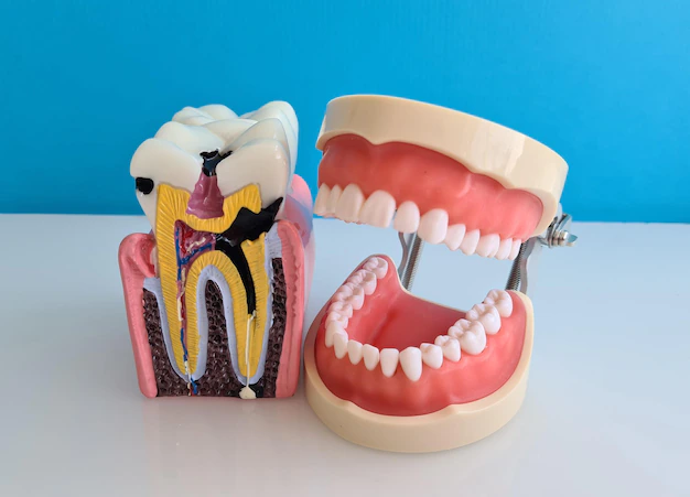 Everything You Need To Know About Prosthodontics
