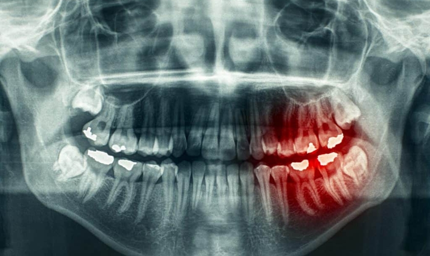 Image of emergency dental-what would be considered an emergency dental appointment