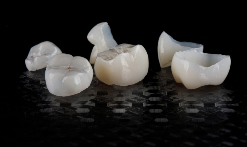 How Long Can You Expect A Dental Crown To Last?